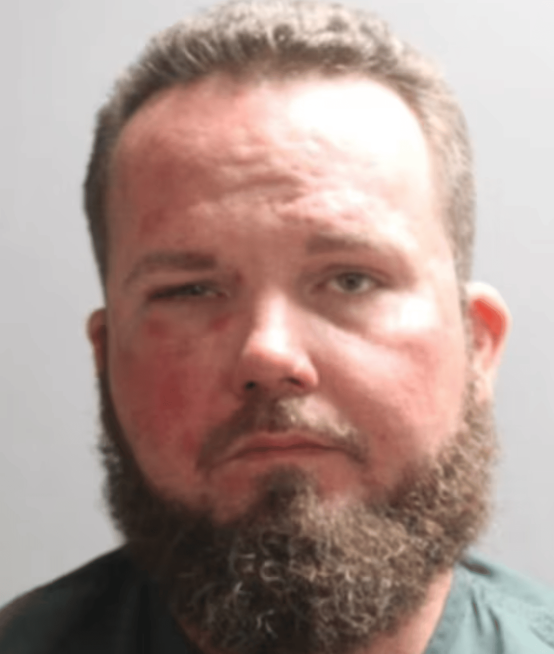 Mugshot showing Maddox with a black eye